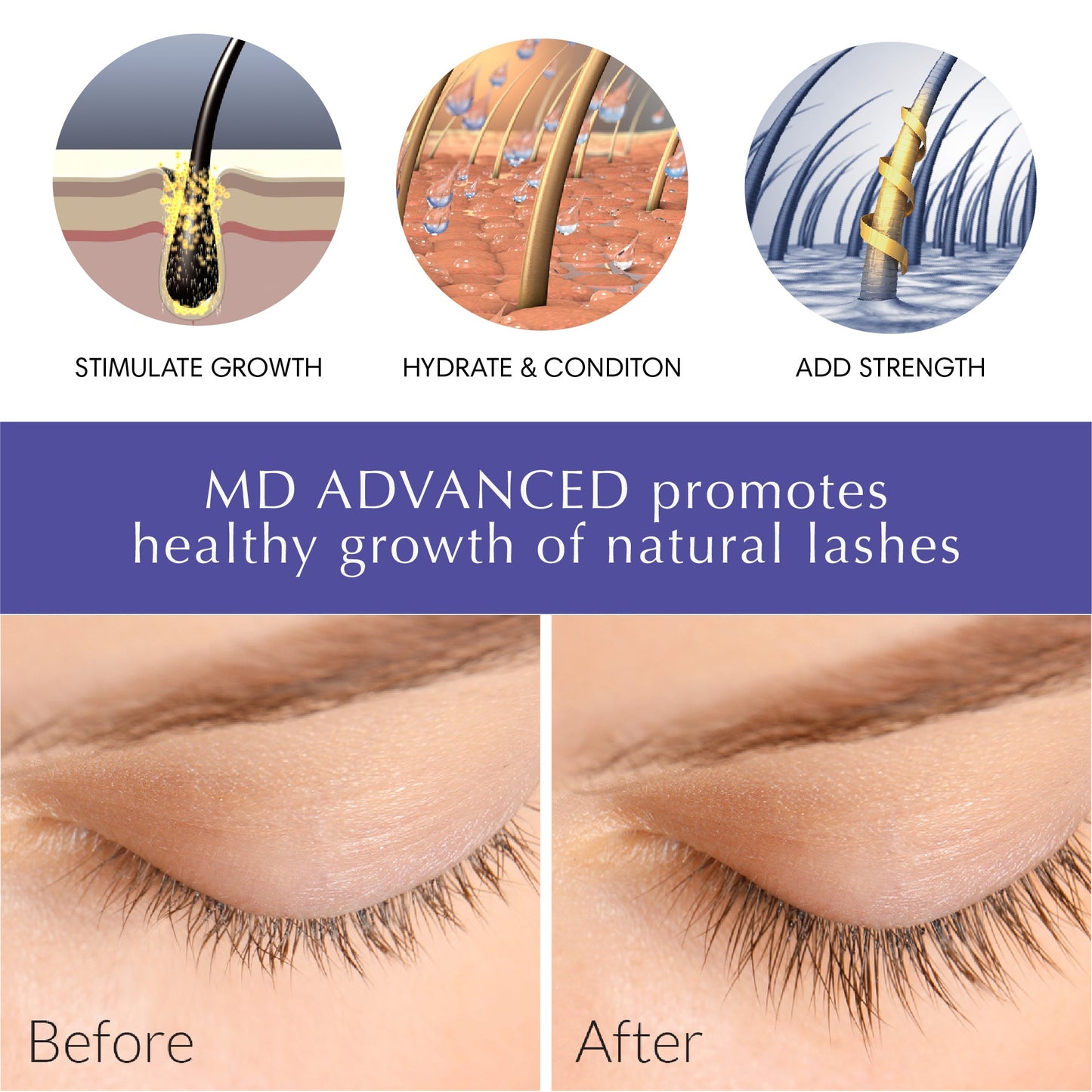 MD Advanced: Suero Avanzado para el Crecimiento de Pestañas BL Lashes®